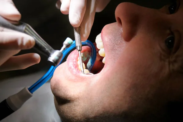 Diş Diş Parlatma Diş Temizliği Diş Temizliği Dişçi Diş Kliniği — Stok fotoğraf