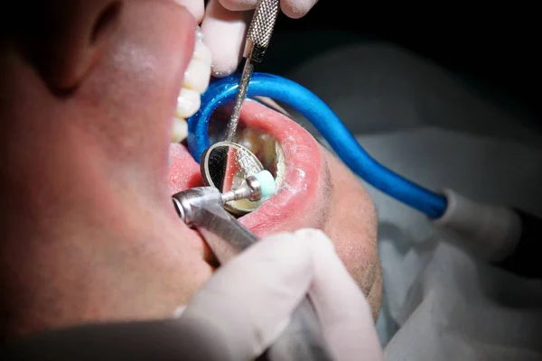 Zubní Zubní Leštění Čištění Hygiena Zubů Zubař Práci Své Zubaře — Stock fotografie