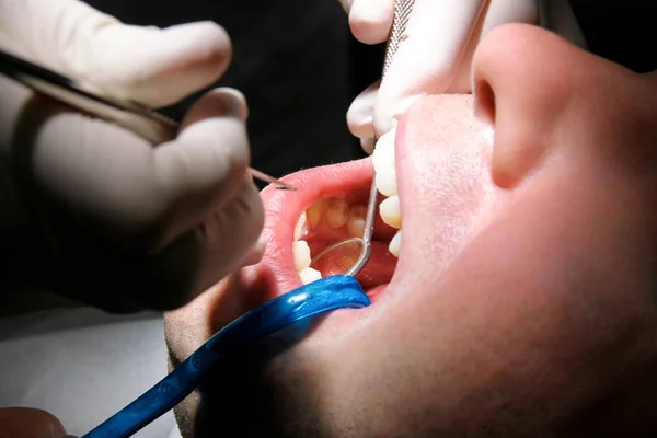 Diş Işaretleyiniz Diş Araçları Sonda Ayna Emme Borusu Ağzında Diş — Stok fotoğraf
