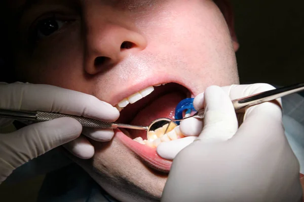 Zubní Prohlídka Zubní Prohlídku Dentální Nástroje Sondou Zrcadlo Sací Trubice — Stock fotografie