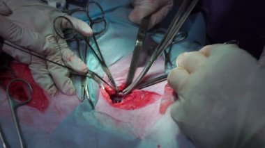 Cerrah arter makas keser