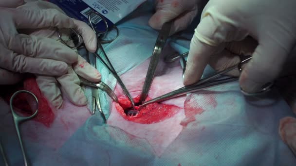 Operation. Die Ärzte schnitten die Arterie mit der Schere durch — Stockvideo
