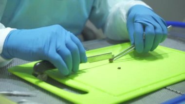 Doktor formalin içinde hazırlanan bir tümör keser