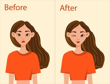 Sivilce tedavisi öncesi ve sonrası kız. Çizgi film tarzı. Vektör illüstrasyonu