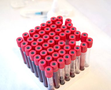 Test tüplü doktor test tüpleri için kan tüpleri ve Coronavirus için laboratuvar testleri.