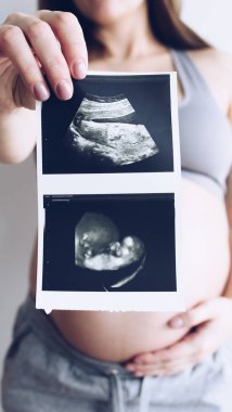 Bebeğinin ultrason taramasıyla hamile bir kadın. Hamile kadın karnını tutuyor ve ultrasonunun fotoğrafını çekiyor..