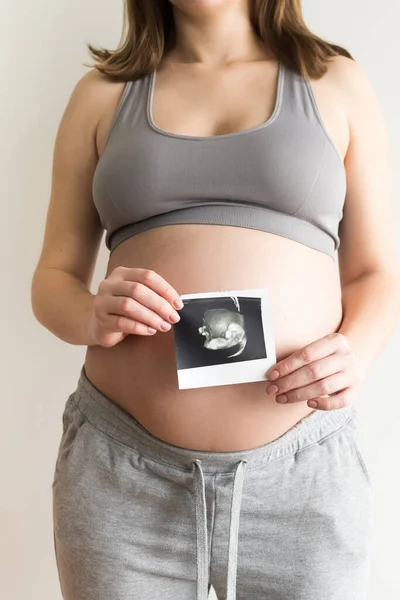 Mujer Embarazada Con Ecografía Bebé Mujer Embarazada Sostiene Estómago Una — Foto de Stock