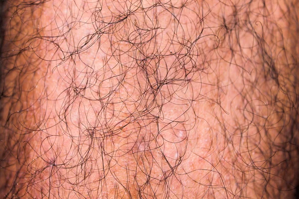 Männliche Haarige Bein Detail — Stockfoto