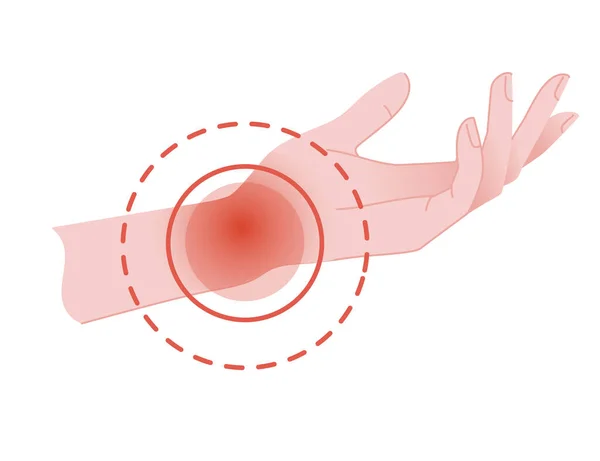 Human wrist pain with red pain circle flat vector illustration on white background — Stock Vector