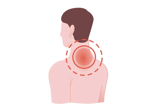 Painful neck concept with human pain circles on back of the neck cartoon flat design vector illustration on white background — Stock Vector