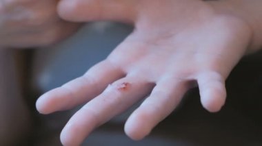 Anne çocuğun parmak yaraya yara bandı koyar.
