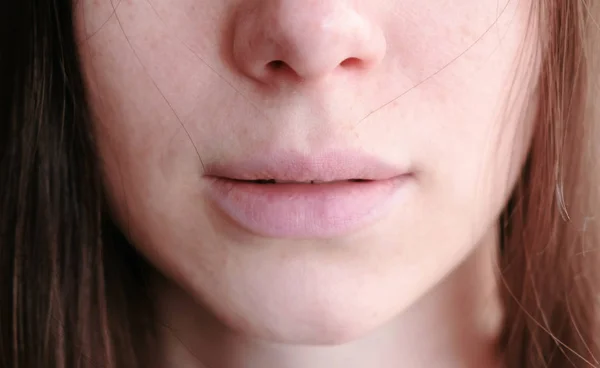 Крупный план женщины губы и веснушки на лице . — стоковое фото