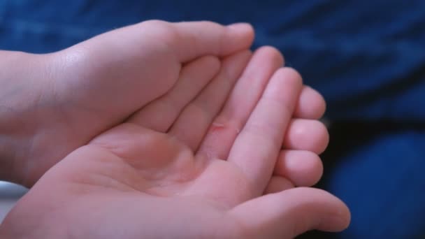 Moeder verwerkt de snee in de vinger van haar kind met een alcohol-servet. Close-up van de handen. — Stockvideo