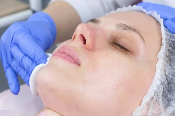 Kosmetolog tørrer ansigtet af en ung kvinde med bomuldspuder. Set fra siden. Hænder af kosmetolog i handsker og et ansigt closeup. Skønhedsbehandlinger til ansigtet . - Stock-foto