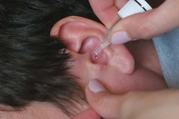 Woman buries drops in a mans ear. Treatment of ear diseases. hands and ear close-up. — Stock Photo, Image