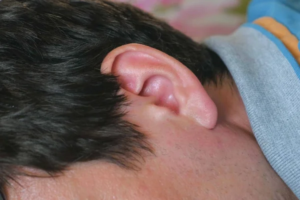 Mens ear close-up. Tratamento de doenças do ouvido . — Fotografia de Stock