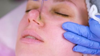Mekanik Şevval özçelik güzellik, yüz temizleme. Güzellik uzmanı hasta tıbbi iğne burun üzerinde sivilce sıkmak.