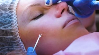 Yüz Güzellik uzmanı temizlik. Sivilce burnuna bir iğne ve büyüteç ile sıkma. Yakın çekim yüz.