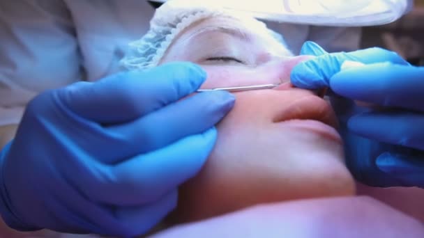 Mechanische reiniging van het gezicht aan de schoonheidsspecialiste. Schoonheidsspecialist knijp de acne op de neus van de patiënt met medische naald. — Stockvideo
