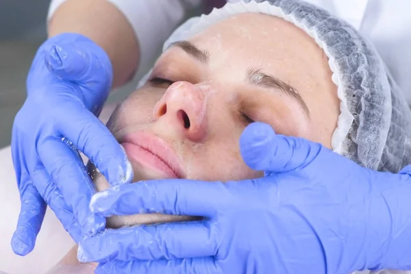 Cosmetologist wipes the face of a young woman with cotton pads. Hands of the beautician in gloves and a face closeup. Beauty treatments for the face.