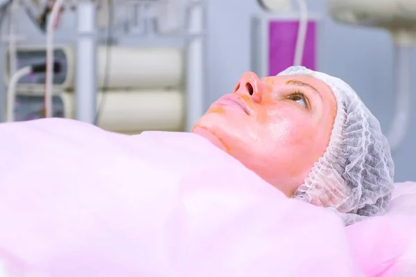 Химический пилинг лица женщины. Очистка кожи лица и ослепительные веснушки кожи в клинике . — стоковое фото