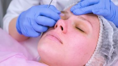 Mekanik Şevval özçelik güzellik, yüz temizleme. Güzellik uzmanı hasta tıbbi iğne yüzünde sivilce delip geçiyor..