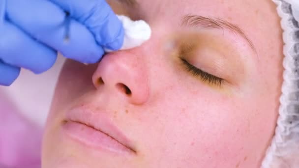 Mechanische reiniging van het gezicht aan de schoonheidsspecialiste. Schoonheidsspecialist knijp de acne op de neus van de patiënt medische naald. — Stockvideo