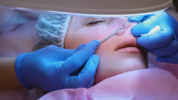 Mechanical cleaning of the face at the beautician. Cosmetologist squeeze the acne on the nose of the patient with medical needle. — Stock Video