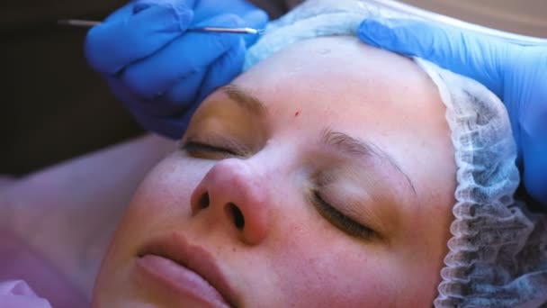 Nettoyage mécanique du visage chez l'esthéticienne. Cosmetologue serrer l'acné sur le front du patient avec une aiguille médicale. Gros plan sur le visage . — Video