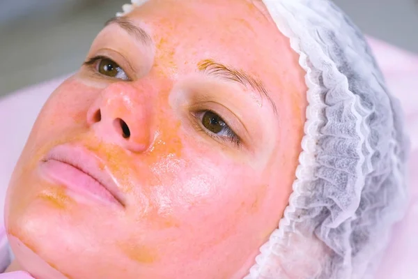 Chemical peeling o the womans face. Cleaning the face skin and lightening freckles skin. Close-up face. — Stock Photo, Image