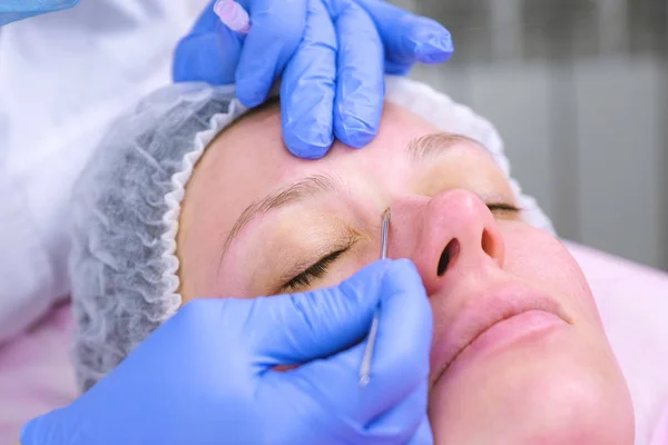 Mechanische reiniging van het gezicht aan de schoonheidsspecialiste. Schoonheidsspecialist squeeze, de acne op het gezicht van de patiënt medische naald. — Stockfoto