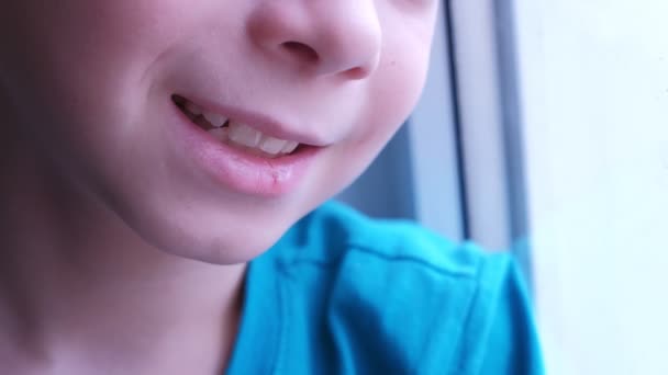 Niño sonriente con los labios secos agrietados, primer plano de boca . — Vídeo de stock