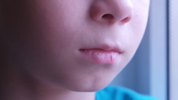 Мальчик с треснувшей сухой губой, рот крупным планом . — стоковое видео