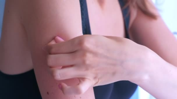 Женщина удаляет шелушение обожженной кожи после слишком сильного воздействия солнца . — стоковое видео
