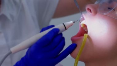 Diş hijyenist diş hekimi kadın ultrasonik temizlik dişleri yapar, closeup görünümü.