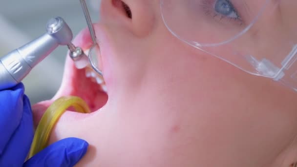 Чистка зубов стоматологом и полировка женских зубов осуществляется с помощью дрели, крупным планом . — стоковое видео
