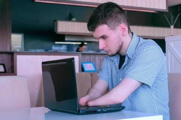 Behinderter Freiberufler mit amputierten zwei Stummelhänden im Café arbeitet am Laptop. — Stockfoto