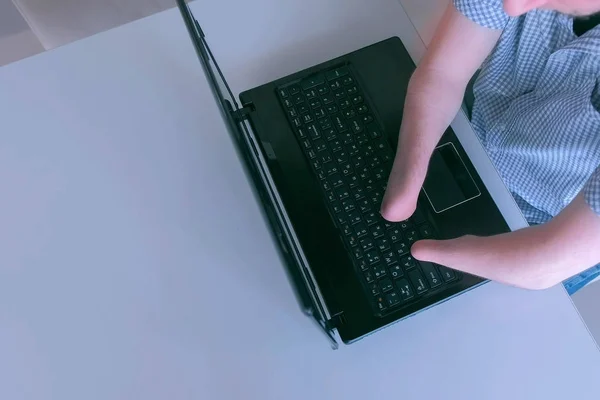 Niepełnosprawny człowiek z amputowane ręce Stump jest wpisanie na laptopa, zbliżenie widok z góry. — Zdjęcie stockowe