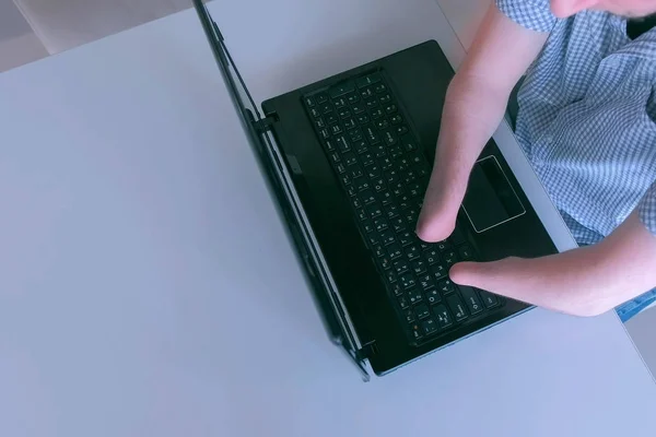 Behinderter Mann mit amputierten Stummelhänden tippt auf Laptop, Nahaufnahme von oben. — Stockfoto