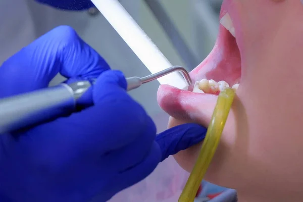 El higienista dental hace que la limpieza ultrasónica vierta los dientes con agua, vista de cerca . — Foto de Stock