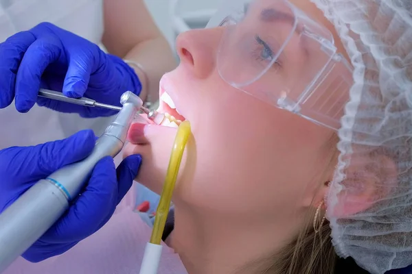 Zahnarzt putzt Frauenzähne mit Bohrmaschine, Nahaufnahme Seitenansicht. — Stockfoto