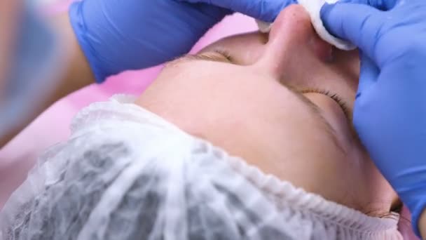 Косметолог стирает женское лицо с маски с помощью хлопковых прокладок. Крупный план . — стоковое видео