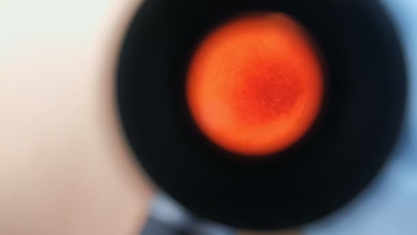 Surgeon examines mole uses dermatoscope, closeup view through magnifier. — Stock Video