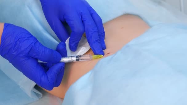 Chirurg daje zastrzyk znieczulenia miejscowego do pacjenta przed laserowym usunięciem Mole. — Wideo stockowe