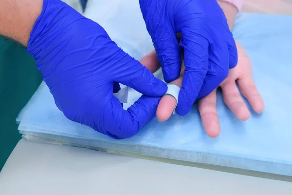 Хірург запечатує палець пацієнта штукатуркою після видалення бородавок, крупним планом руки . — стокове фото