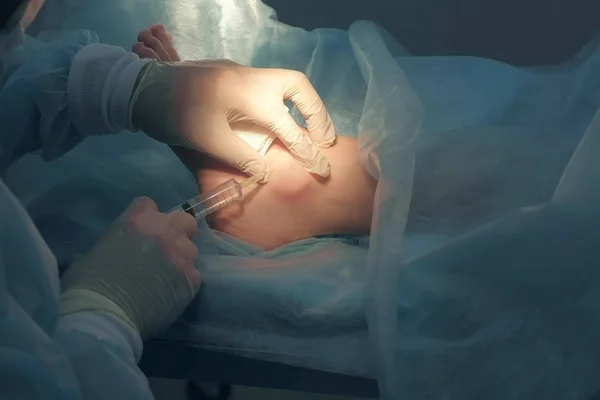 Homem cirurgião introduzindo droga para anestesia local antes da cirurgia na perna do paciente . — Fotografia de Stock