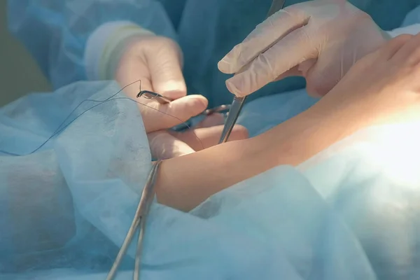 Suturas del tobillo del cirujano durante la cirugía con puntos limpios después de retirar el higroma. — Foto de Stock