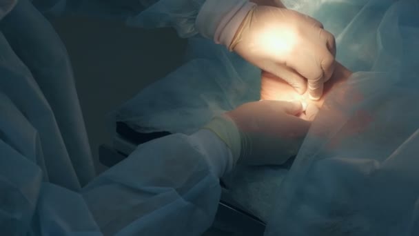 Surgeon making surgery of removal ankle hygroma in hospital in operating room. — Stock Video