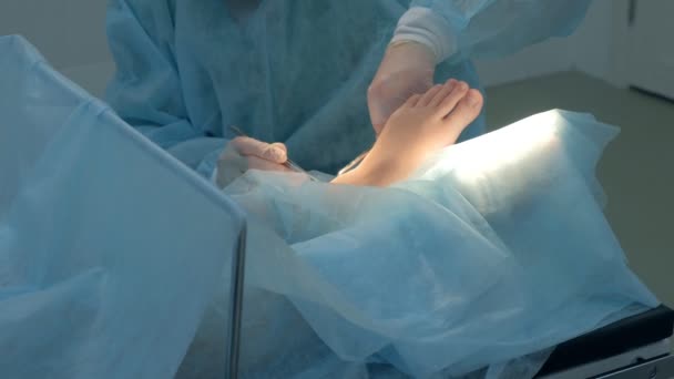 Chirurgo che effettua un intervento chirurgico di rimozione igroma della caviglia in ospedale, primo piano mani. — Video Stock