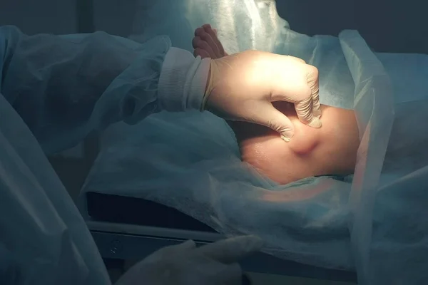 Chirurg tastet Bein vor Operation ab, um Knöchelhygroma im Gelenk zu entfernen. — Stockfoto